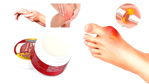 Kem Bôi Gout Sumifun Gout Ointment - Kem Thảo Dược Chăm Sóc Xương Khớp Giảm Sưng Đau Gout và Xẹp Tophi