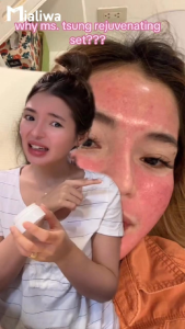 Ms Tsung Demure Rejuvenating Set Pampaputi Whitening Exfoliating Hydrating Moisturizing Beauty Skin Care Kojic Soap Facial Toner Sunblock Cream SPF30 Night Cream Sunscreen Acne Pimples Peklat Scar Blemishes Wrinkles Dark Spot Pekas Melasma Moisturizer