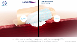 Convatec Aquacel Foam Pro 10 cm x10 cm(Ref: 422357)