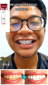 YAYASHI SP-4 Probiotic Whitening Toothpaste Teeth Whitening Toothpaste Oral Care Toothpaste Fresh Breath Prevents Plaque120g