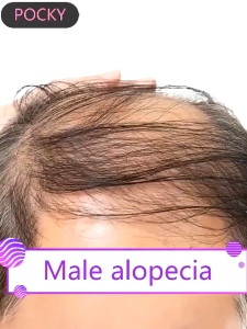 Original Anti hair fall shampoo ginger shampoo rambut gugur Oil Control hair growth lebatkan rambut生姜洗发水