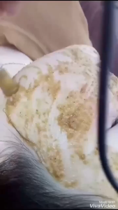 Bột Hồng Sâm Gogo Cấy Trắng Da Mặt | Cấy Trắng Nano Chăm Sóc Da