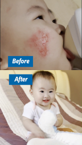 [2 Boxes] LABO Nutrition Biogenics 16 Predigested Probiotics for IBS Digestive Balance Bowel Regularity Immunity Diarrhoea Constipation Cleanse Colon & Eczema Supplement • Made in Japan • 15 Sachets