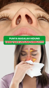 Propolis sm Obat Sinusitis Rhinitis Polip Hidung obat bersin menahunobat hidung tersumbat BPOM