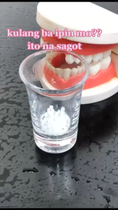 Penambal Gigi Lubang 2000 Butir - Gigi Palsu Silikon 2000 Butir - Temporary Tooth Repair Kit Denture Teeth 2000 Butir