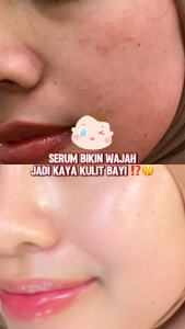 Hanasui Advance Retinol Serum Memudarkan Flek Hitam Mencegah Penuaan