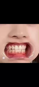 👑2025 ผลิตภัณฑ์ล่าสุด👑 SP-14 ยาสีฟันฟันขาว ยาฟันฟันขาว โปรไบโอติกยาสีฟัน ยาสีฟันไวท์เทนนิ่ง ขจัดคราบหินปูน ลดกลิ่นปาก ช่วยให้ฟันขาวขึ้นแบบธรรมชาติ