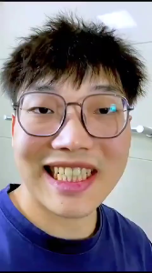 Bamboo Charcoal ODOL Toothpaste Pasta Gigi Pemutih Gigi Kuning dan Penghilang Karang Gigi 105g Cerianti Lynn Design