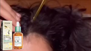 Eelhoe Peptide Density Serum: A Comprehensive Guide for Hair Growth & Prevention of Baldness