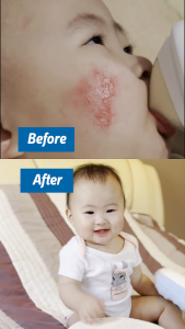 [3 Boxes] LABO Nutrition Biogenics 16 Predigested Probiotics for IBS Digestive Balance Bowel Regularity Immunity Diarrhoea Constipation Cleanse Colon & Eczema Supplement • Made in Japan • 15 Sachets