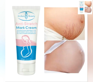 Aichun Beauty Anti-Stretch Mark Cream: Solusi Menghilangkan Bekas Luka & Menghaluskan Kulit