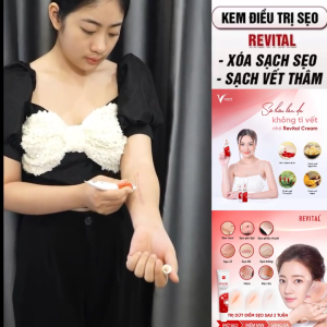 Kem Mờ Sẹo REVITAL 30g Hỗ Trợ Làm Mờ Sẹo Thâm Nám Giúp Dịu Da Cho Làn Da Sáng Mịn Hồng Hào - HÀNG CHÍNH HÃNG