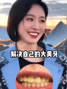 Dr Roelof whitening tooth essence whitening teeth whitening and toning optical color repair teeth small purple bottle essence whitening supplement Whitening dr roelof toothpaste