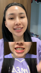 Serum Trắng Răng Unismile Hỗ Trợ Cải Thiện Vết Ố Vàng Unikare Dung Tích 10ml