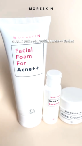 Moreskin Acne Series - Moreskin Cosmetic - Paket Moreskin Acne - Paket Perawatan Jerawat - Moreskin Nasa -ginal Nasa - Natural Nasa - BPOM - Ken Herbal