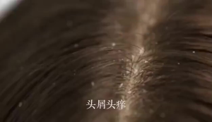 Coconut Oil Shampoo and Conditioner Set: Perfumed Anti Dandruff Shampoo with Long-Lasting Fragrance 500ml