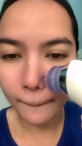 Areti XN-8030 Pore Suction Device.Multifunctional blackhead remover-pimple extractor tools for a beautiful and younger looking skin (Complete Set with charger). Pore cleaner for face and nose with three attachments.