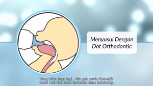 HUKI Botol Susu Bayi 120 ml Nipple Dot GEPENG Orthodontic