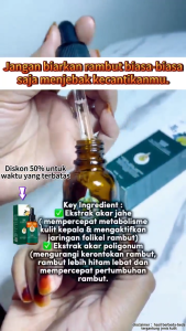 Ginger King Serum Anti Botak: Solusi Terbaik untuk Rambut Botak & Rontok