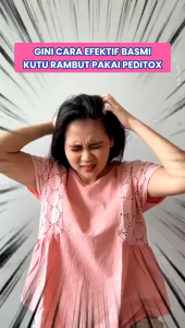 PEDITOX 50 ml - Penghilang Kutu Rambut / Pembasmi Kutu Rambut / Kutu / Perawatan Rambut