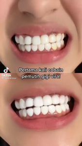 BREYLEE Teeth Powder Variant 30 gr - Mencerahkan gigi (1pc) - Peach Freezing Mint Lime Green Tea Lynn Design