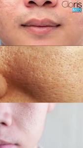 Clorismen Brightening Cream - Krim Pelembap dan Pencerah Wajah Pria