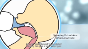 Botol Susu HUKI Dot Gepeng & Dot Bulat 60ml, 120ml & 240ml