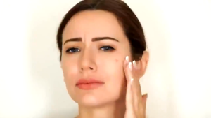 Miếng Dán Giảm Mụn Axit Salicylic 36 Miếng/ Acne Patch