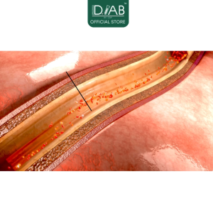 ID.LAB BY CDIP - ID.1(AVOCADO OIL) ลดไขมันคอเลสเตอรอล หลอดเลือดหัวใจ ลดปวดข้อต่อข้อเข่า