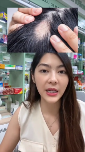 ลินโกะไบโอติน ร้านเจ้าของแบรนด์ LYNCO BIOTIN อาหารเสริมบำรุงรากผม หนังศีรษะ และเส้นผม