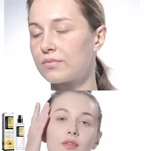 OUHOE Advanced Snail 96 Mucin Powerful essence moisturizing water 100ml snail secretion filtrate 96.3% anti-aging and moisturizing improving wrinkles