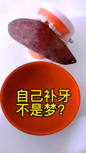 Phục hình răng tức thì  Vật liệu răng sửa chữa hạt tạm thời răng tự làm răng giả (30g)