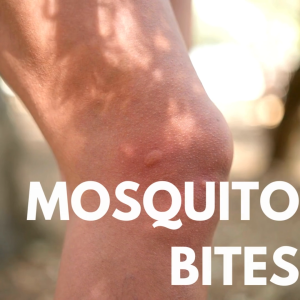 Bhutan #1 Natural Mosquito Repellent Air Spray 200mL Blend of Bhutan Organic Lemongrass Oil Alcohol Based