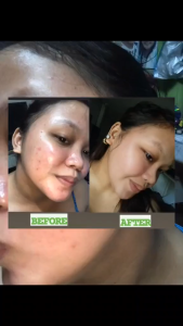 BEAUTY WISE REJUVENATING SET NEW PACKAGING