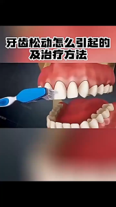 377亮白去渍牙膏 - 直立按压式去黄清新120g  377 Whitening Toothpaste - Upright Pump Anti-Yellowing Fresh Breath 120g