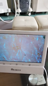 Máy soi da | máy phân tích da ip.a.t 11inch