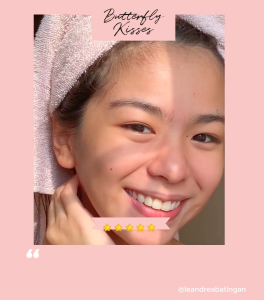 Butterfly Kisses Skin Perfecting Kit (Complete set of Soap Exfoliator Toner Day Cream Night Cream)