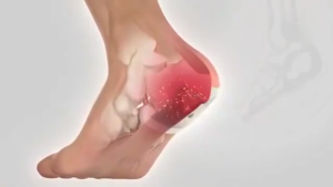 Heel pain patch Foot Pain Relief Patch Pain Relieving Plaster 12pcs Best for Heel Pain Plantar Fasciitis Heel Spur Foot Care