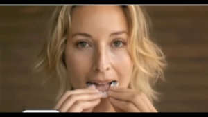 Snap On Smile Veneers: Solusi Gigi Palsu Pria & Wanita