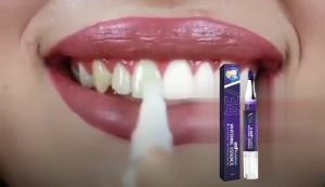 West&Month  V34 Teeth Whitening essence ปากกาฟอกสีฟัน ทำความสะอาดฟัน ปากกาเจลฟอกสีฟัน ขจัดคราบหินปูนและคราบเหลือง ทำความสะอาดฟันอย่างมีประสิทธิภาพ ให้ลมหายใจสดชื่น 4ml