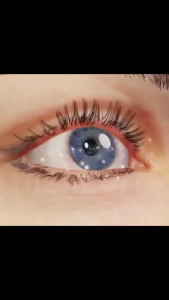 Lutein Eye Drops 15ml Treatment Dry Eyes Cataracts Blurry Vision tired eyes Red Eye of Eye Supplement