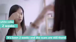 Scar Remover Cream Dermatix Ultra Scar Gel Keloid Scar Remover Hilangkan Parut Jerawat Surgical Scars Hypertrophic Scars Stretch Marks