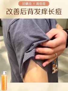 Tinh Chất Gel Tắm Dược Liệu Clean Giảm Mụn Lưng Mụn Body Viêm Nang Lông Dày Sừng Giảm Thâm Dưỡng Da Mịn Màng