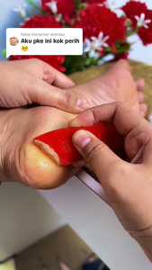 Tumitku Obat Kaki Pecah Pecah Untuk Kaki Solusi Kaki Kapalan Perawatan Kaki