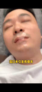 X-Breathing Patch Mouth Breathing Patch to Prevent Snoring Anti-Snoring Patch