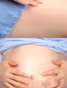 ครีมลดรอยแตกลาย 7วันทางด้านล่าง ครีมทาหน้าท้อง/ล่าง ครีมลดผิวแตก ครีมทาท้องลาย