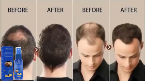 penumbuh rambut  penumbuh rambut botak serum penumbuh rambut serum rambut rontok Penumbuh Rambut Cepat Anti Rontok Mengatasi Botak