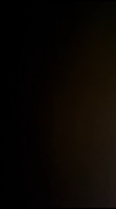 case infinix gt 20 pro infinix note 50 4g infinix note 50 pro macaron case so cool hologram case