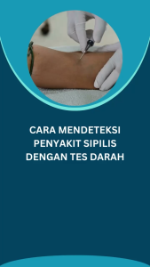 Gang Jie: Obat Herbal Alami untuk Sipilis, Gonore & Kencing Nanah