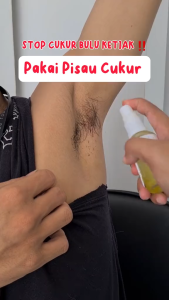 Bundling Isi 2 Kondang Hair Removal Spray Obat Perontok Bulu Permanen